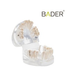 Modelo dental para práctica de ortodoncia BADER® DENTAL