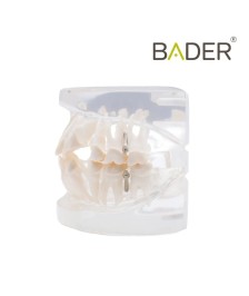 Modelo dental para práctica de ortodoncia BADER® DENTAL