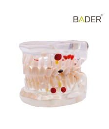 Modelo dental transparente...