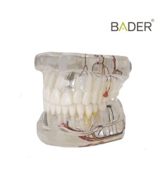 Modelo dental de implante con nervio BADER® DENTAL